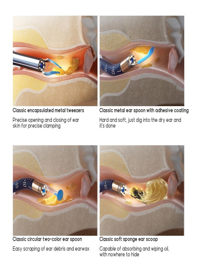 BEBIRD Official Original Accessory Only for Earsight Plus or R1 Ultra- 14 PCS Replacement Tip for Wet/Dry Wax Cleaning - Ear Spoons Accessories Set (New Spiral Structure!) - Image 4